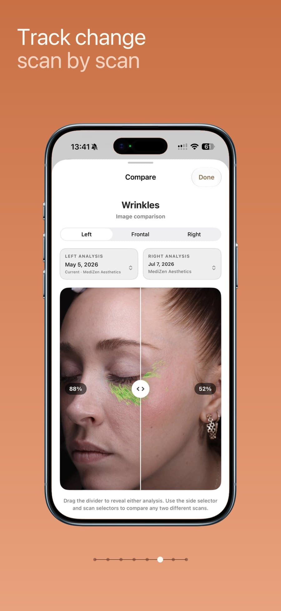 Side-by-side scan comparison with a draggable divider